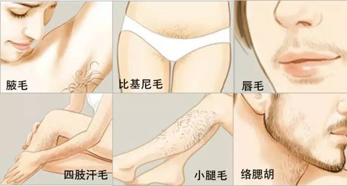 脱毛价格限时优惠,一元脱毛全城推荐