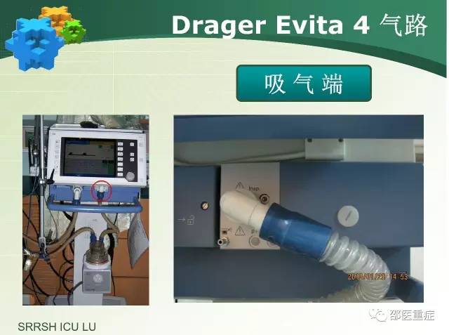 有创机械通气操作,机械通气英文缩写