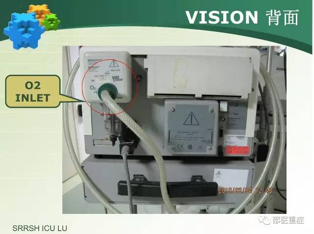 有创机械通气操作,机械通气英文缩写