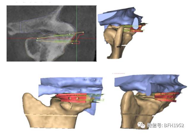 北京友谊医院颞下颌关节科,北京友谊医院手术单