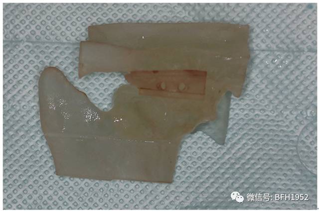 北京友谊医院颞下颌关节科,北京友谊医院手术单