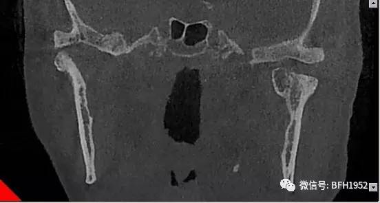 北京友谊医院颞下颌关节科,北京友谊医院手术单