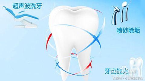 牙齿有牙垢牙黄怎么去除,牙齿黄有牙垢怎么去除小窍门
