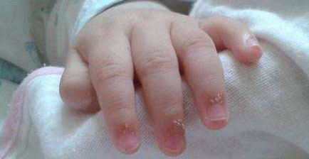 浙江4岁女孩拔手指,4岁女孩被刺伤自救