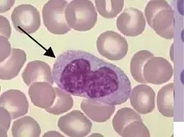 外周血细胞涂片的正常值,外周血细胞分析多长时间出结果