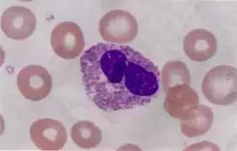 外周血细胞涂片的正常值,外周血细胞分析多长时间出结果