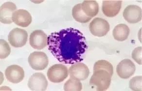 外周血细胞涂片的正常值,外周血细胞分析多长时间出结果