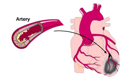 收藏!十个保健小动作,每天坚持,堪比灵丹妙药!