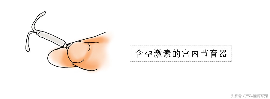 痛经有可能是癌症吗,痛经可能是妇科炎症吗