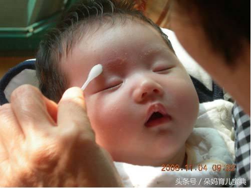 宝宝湿疹反复怎么办教你一招去除,宝宝湿疹小妙招