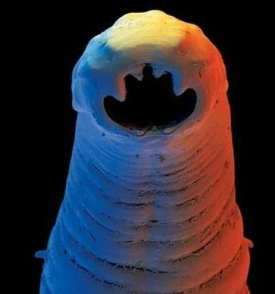 身体有这些症状要注意,肚子里有寄生虫的症状吃什么药