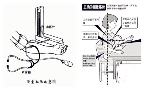 水银血压计和电子血压计各种利弊,水银血压计和电子血压计同时测量