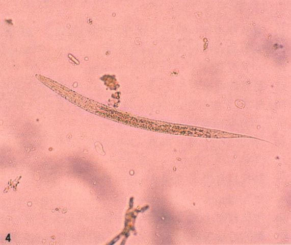 身体有这些症状要注意,肚子里有寄生虫的症状吃什么药