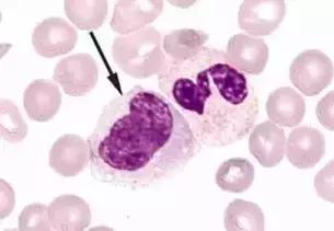 外周血细胞涂片的正常值,外周血细胞分析多长时间出结果