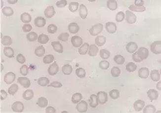 外周血细胞涂片的正常值,外周血细胞分析多长时间出结果