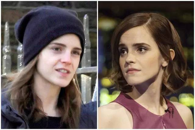 美女与野兽｜天生法令纹只能靠整容吗？那是因为你没看这篇！