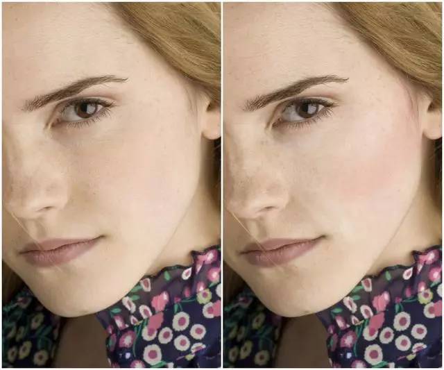 美女与野兽｜天生法令纹只能靠整容吗？那是因为你没看这篇！