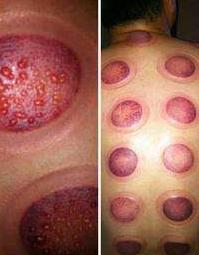 还记得巴西奥运会上，美国飞鱼菲尔普斯背上的种的大草莓吗？