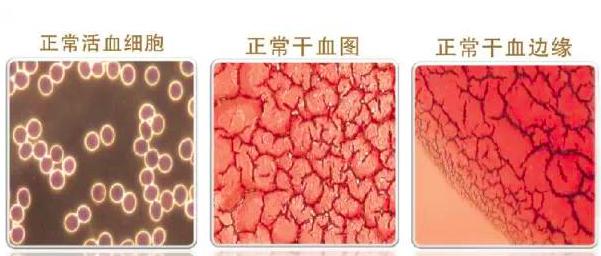 中老年预防血稠用什么药,老年人怎么注意血管