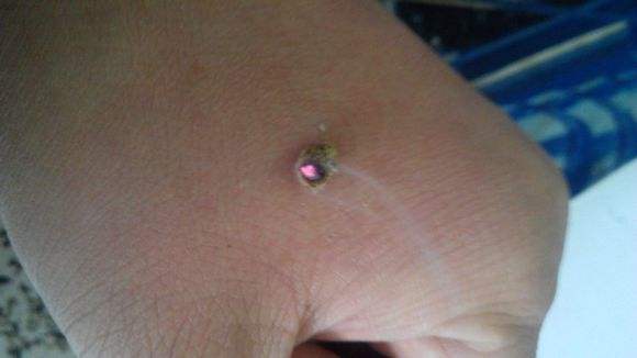 揭开蛊术的神秘面纱,揭开针灸神秘面纱想学针灸