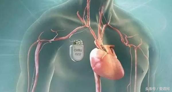 高钾血症猝死作用机制,高钾血症会突然猝死吗