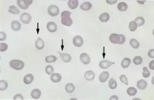 外周血细胞涂片的正常值,外周血细胞分析多长时间出结果