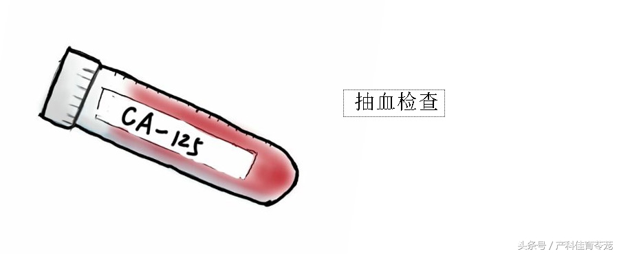 痛经有可能是癌症吗,痛经可能是妇科炎症吗