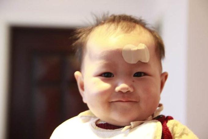 摔肿了可以揉吗,宝宝摔着头怎么消肿