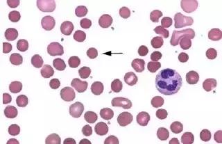 外周血细胞涂片的正常值,外周血细胞分析多长时间出结果