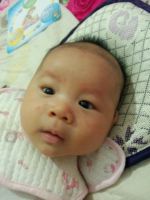 宝宝一急眉毛处就红怎么回事,宝宝眉毛发红是怎么回事