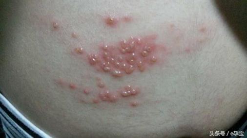 孕期无小事,孕期不可忽视的小毛病