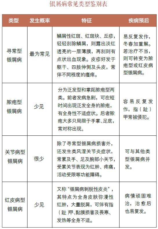 银屑病本质上不属于皮肤病,银屑病是普通的癣吗