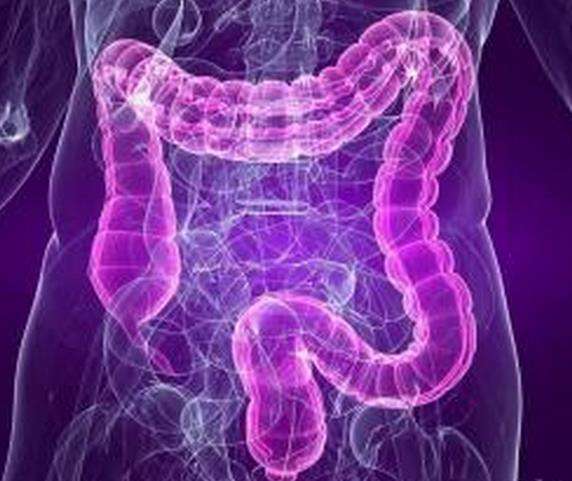 林奇综合征患者的直肠癌风险,结直肠癌怎么查林奇综合征