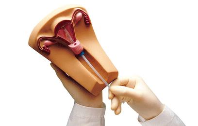 节育环取出注意些什么,女性节育环取环前注意事项