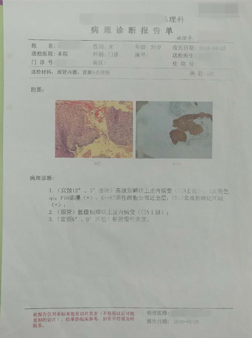 面部疣hpv,非青春期痤疮跟hpv有关系吗