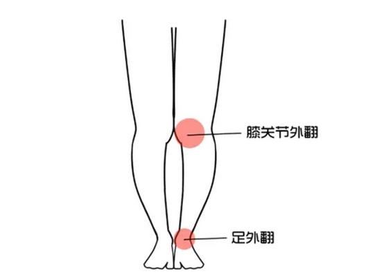 腿型不直如何矫正,老年人长时间大腿弯曲该怎样矫正