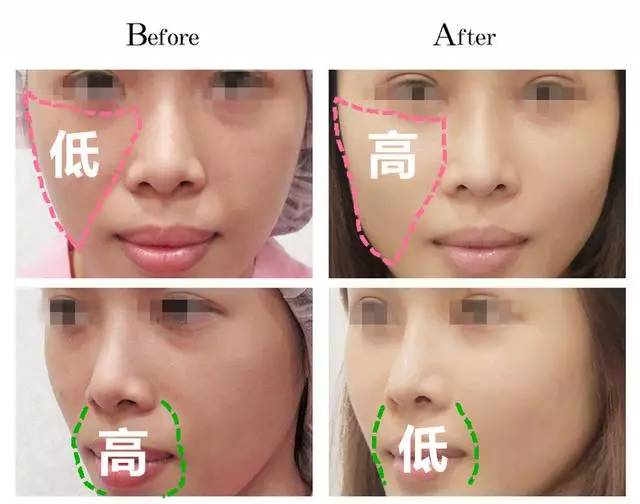 美女与野兽｜天生法令纹只能靠整容吗？那是因为你没看这篇！