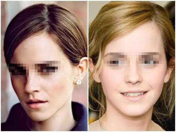 美女与野兽｜天生法令纹只能靠整容吗？那是因为你没看这篇！