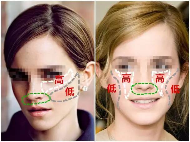 美女与野兽｜天生法令纹只能靠整容吗？那是因为你没看这篇！