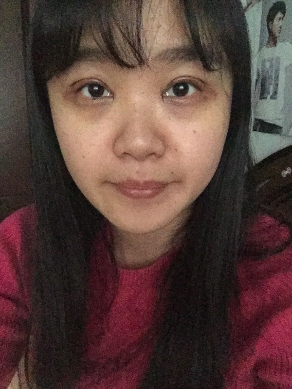 全切双眼皮感觉很窄后期会变宽嘛,内双的人割双眼皮会更自然吗