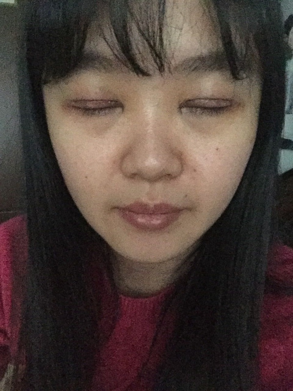 全切双眼皮感觉很窄后期会变宽嘛,内双的人割双眼皮会更自然吗