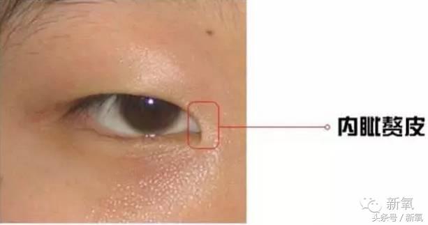 为什么开眼角会变漂亮,为什么开眼角很奇怪