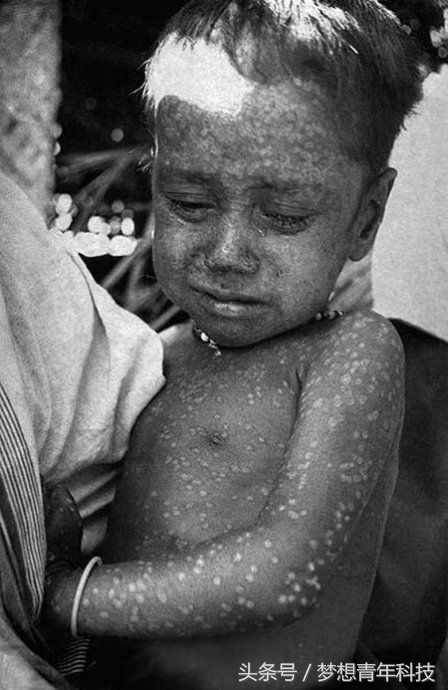 iphone7亮黑后背氧化,iphone7亮黑小斑点