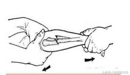 缃楁皬姝ｉ娉曚箣姝ｇ瓔鍏硶,姝ｉ鍏硶鍙堝彨浼ょ鍏硶