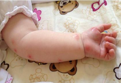 春游带孩子出游需要准备哪些东西,寒假带孩子出游注意事项和安全