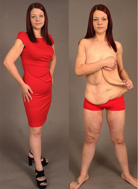 胖女二婚,二婚胖女孩减肥