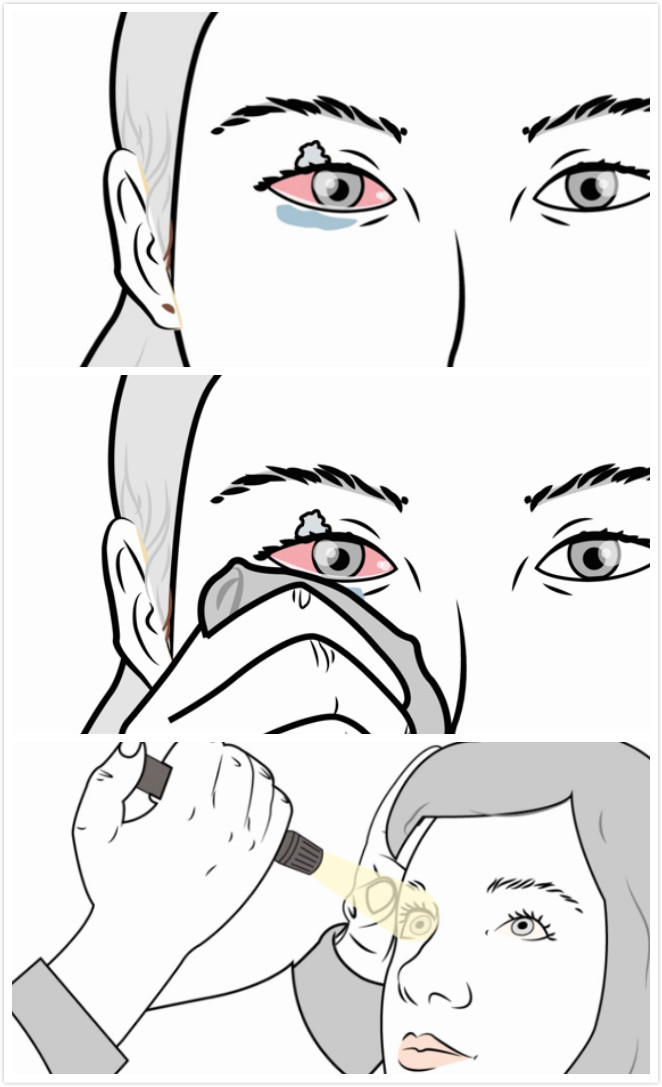 去除强力胶最快的方法,去除强力胶最快方法