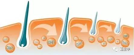 痰湿为什么会导致脱发,雄性激素脱发是什么原因导致的