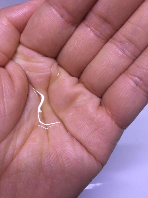 鼻子两边干痒脱皮什么原因,鼻子一周脱皮疼怎么办