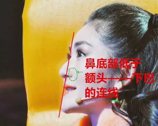 美女与野兽｜天生法令纹只能靠整容吗？那是因为你没看这篇！